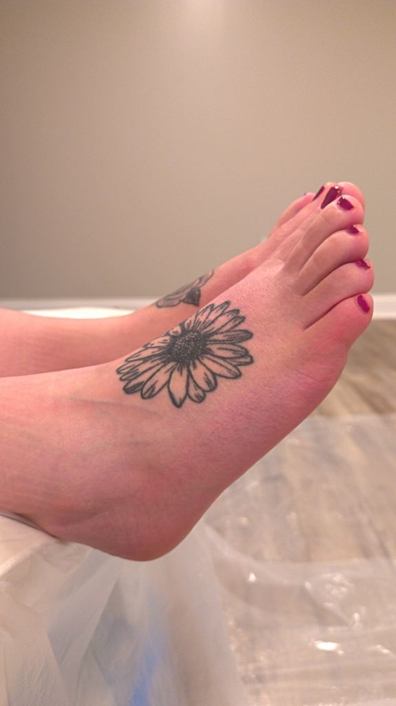 Before - Side View